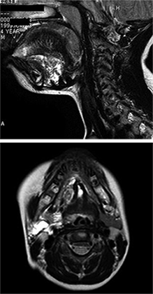 >}2 MRI@T2摜