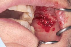 頬部の腫脹 2020 03月号1ans 診断力てすと Dental Diamond デンタルダイヤモンド