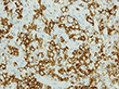 b:CD20×400